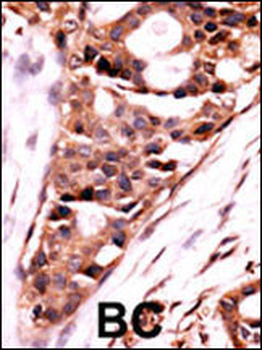 PPP3CB Antibody (N-term)