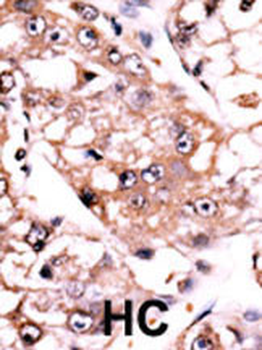 PP2A alpha Antibody (C-term)