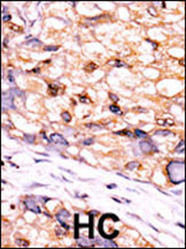CTDSP1-V250 Antibody (C-term)