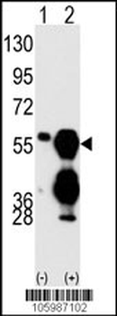 PPM1F Antibody (C-term)