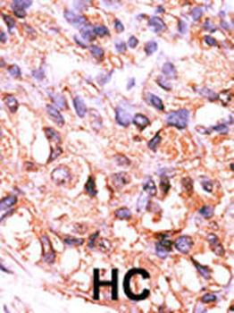 PPM1F Antibody (C-term)