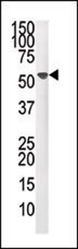 PPM1F Antibody (N-term)