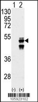 PPM1F Antibody (N-term)