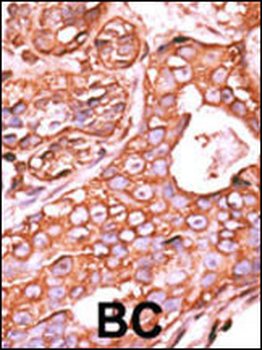 PPM1F Antibody (N-term)