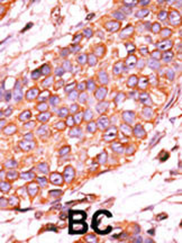 DUSP13-L184 Antibody (C-term)