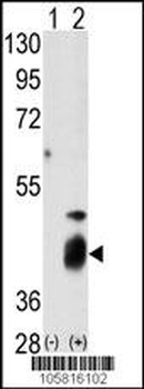 DUSP7 Antibody (N-term)