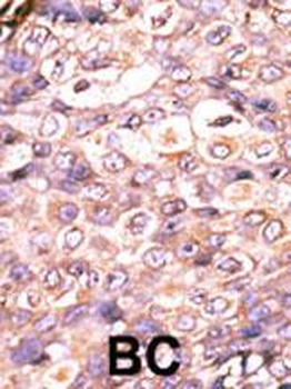 DUSP7 Antibody (N-term)