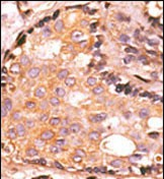 DUSP4 Antibody (C-term)