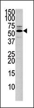 PTEN Antibody (C-term)
