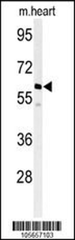 PPM1G Antibody (Center)