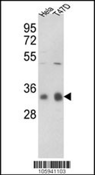 PP1C gamma (PPP1CC) Antibody (C-term)