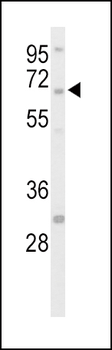 STEP / PTPN5 Antibody (N-Term)
