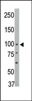 PTPH1 Antibody (Center)