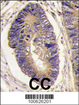 PTPH1 Antibody (Center)