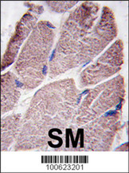 PTPD1 Antibody (Center)