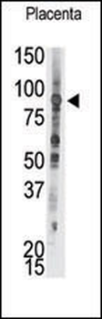 PTP epsilon Antibody (C-term)