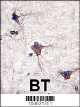 PCPTP1 Antibody (N-term)