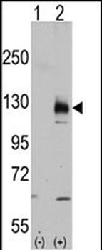 TRPM8 Antibody (C-term C940)