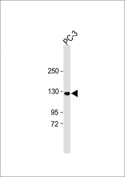 TRPM8 Antibody (C-term C940)