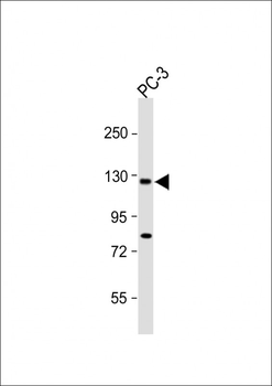TRPM8 Antibody (C-term C940)