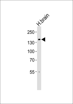TRPM8 Antibody (Center R536)