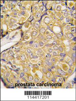 TRPM8 Antibody (Center R536)
