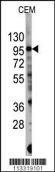 PIK3CG Antibody (S1100)