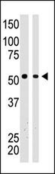 BAIAP2 Antibody (C-term)