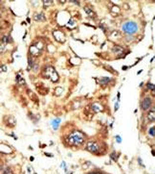 BAIAP1 (MAGI1)Antibody (C-term)