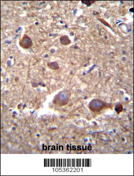 ITPKB Antibody (N-term)