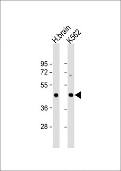 ITPKA Antibody (C-term)