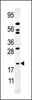 AK1 Antibody (N-term)