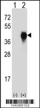 PLAUR Antibody (Center)