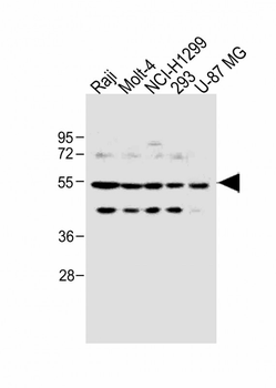 PFKFB4 Antibody (Center)