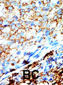 NME4 Antibody (C-term)
