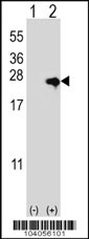NME4 Antibody (N-term)