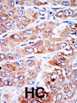 NME4 Antibody (N-term)