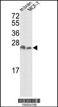YWHAZ Antibody (D231)