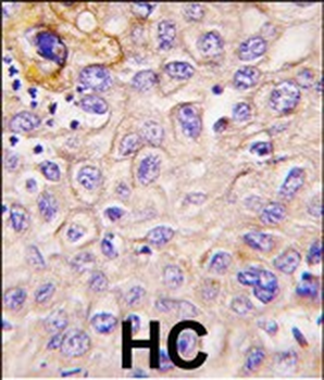 PERK (EIF2AK3) Antibody (Center)