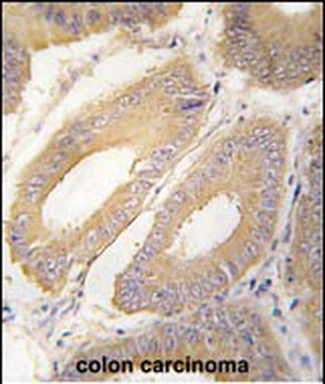 FGF4 Antibody (C-term)