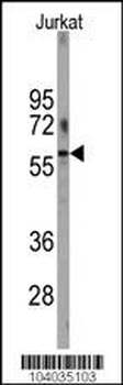 PFKFB1 Antibody (N-term)