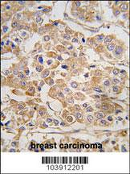 IKK epsilon (IKKE) Antibody (C-term)