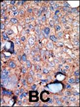 IKK epsilon (IKKE) Antibody (C-term)