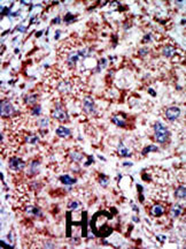 PFKL Antibody (C-term L684)