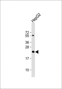 UCK Antibody (C-term)