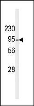 DGKB Antibody (C-term)