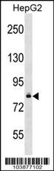 DGKB Antibody (C-term)