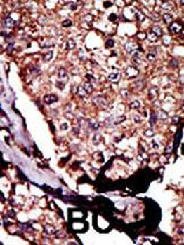 DGKB Antibody (C-term)