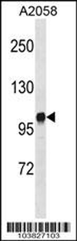 Diacylglycerol kinase iota (DGKI) Antibody (C-term)