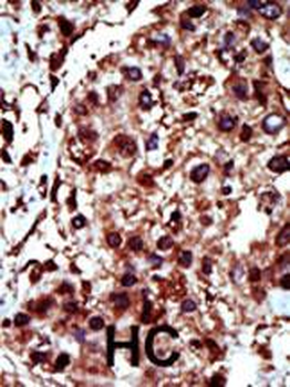 Diacylglycerol kinase iota (DGKI) Antibody (C-term)